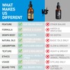 aokur Biotin Beard Oil for Men – Sandalwood Scented Beard