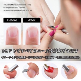 Forahome Cuticle Pusher Cuticle Pusher, Cuticle Processing Set, 4 Types, Cuticle Pusher, Double-sided Cuticle Treatment, Stainless Steel, Durable, Easy to Operate for Beginners, Nail Care, Cuticle Care, Anti-Slip, Easy to Use (Silver)