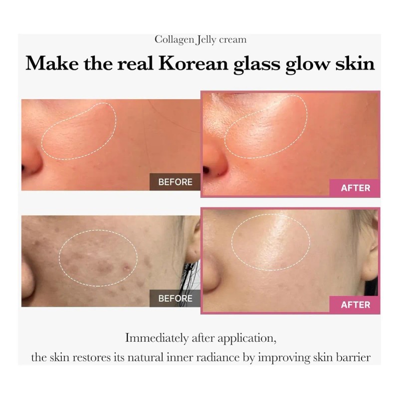 Medicube Collagen Jelly Cream 110 Ml Crema De Colágeno Corea