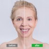 Facial Patches Wrinkle Remover Pads for Forehead Neck Chest Anti