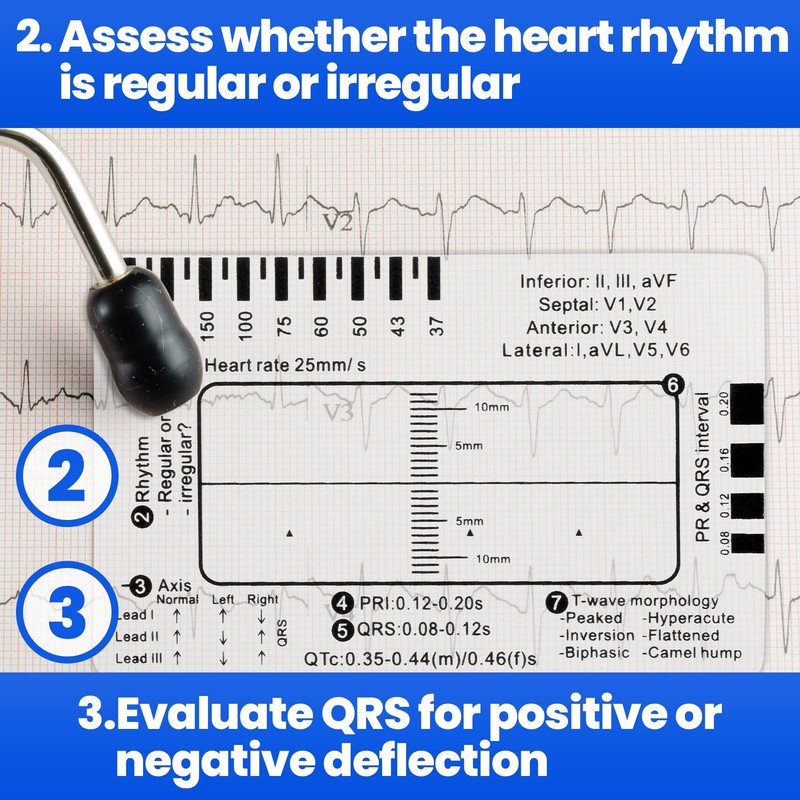 BEIQIYA 10pcs ECG 7 Step Ruler, Transparent EKG Calipers Ruler,