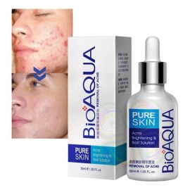 Srum antiacn, reduce granos y espinillas, purifica piel mixta