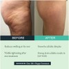 GUAM Crema Liporeductiva Anticelulitis