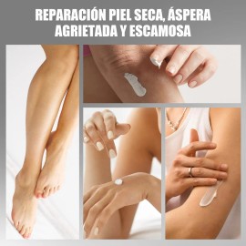 Crema Pies Urea 42 % + Ácido Salicílico 2 % – Exfoliante Intensivo para Piel Muy Seca, Callos y Talones Agrietados
