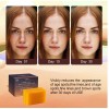 Kojic Turmeric Kojic Acid Brightening Soap Skin Whitening Dark Spots