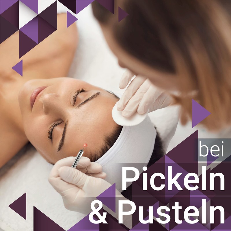 Disposable lancets, lancets, sterile Kosmetex blood lancets