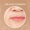 Crema Despigmentante Manchas Melasma Acné Paño