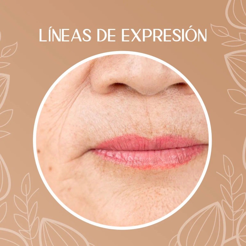 Crema Despigmentante Manchas Melasma Acné Paño