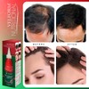 VELFORM Nutritional Hair Application Lotion Stimulates Hair Growth and Prevents