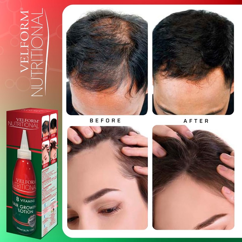 VELFORM Nutritional Hair Application Lotion Stimulates Hair Growth and Prevents