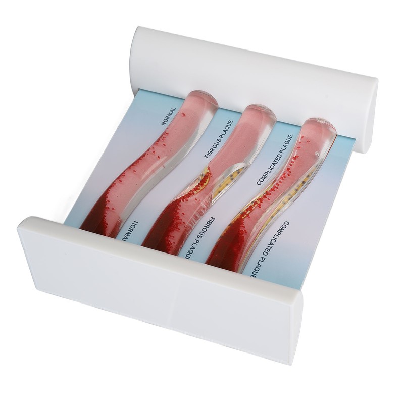 Lipoprotein LDL Blood Vessel Model Low Density Blood Lipid Vessel