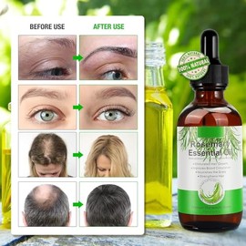 Aceite de Romero para el Cabello, (30ML), Aceite Esencial de Romero Orgánico, 100% Puro Natural, Nutre el Cuero Cabelludo, Elimina el Cabello Seco, Romero para el Cabello