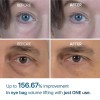 Product Detail Reference 닥터멜락신 팔트 백 크림 10ml Dr. Melaxin