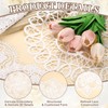 sourcing map 2 Pcs Lace Doilies for Tables, 14 Inch