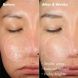 Aha [2-pk] Skin Whitening Body Lotio n+ Vitamin C Brightening Serum,500ml [USA Stock