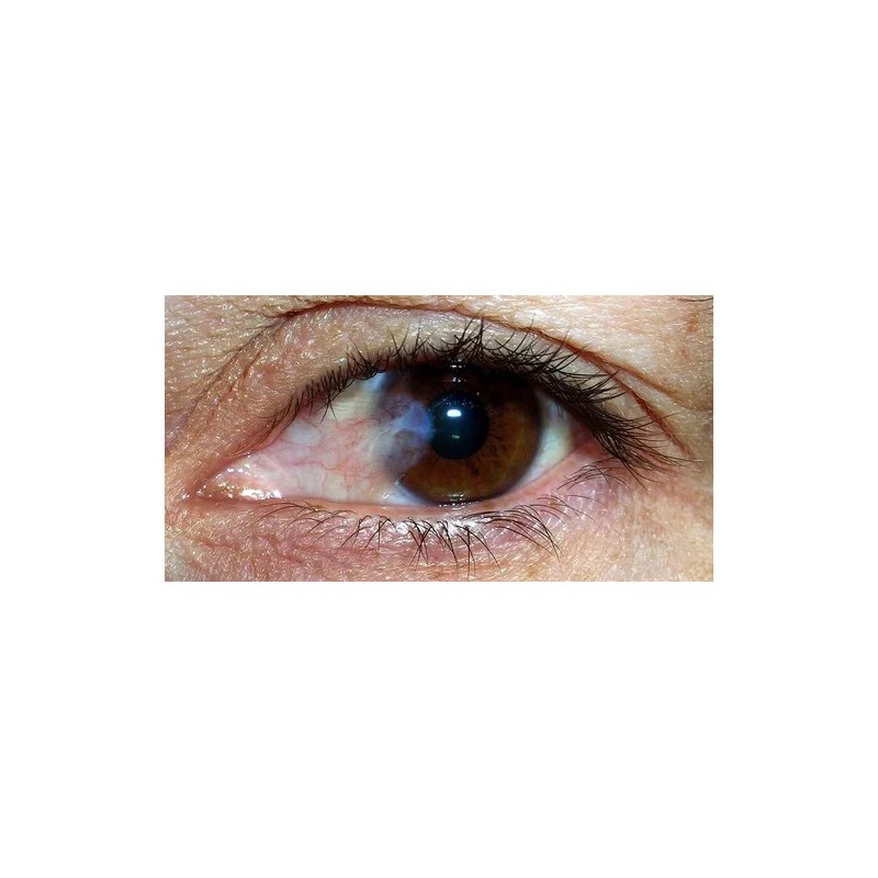 Cineraria Marítima Gotas Naturales Oftálmicas Ojos Cataratas