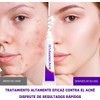 3PCS Crema Ácido Azelaico, Suero Ácido Azelaico