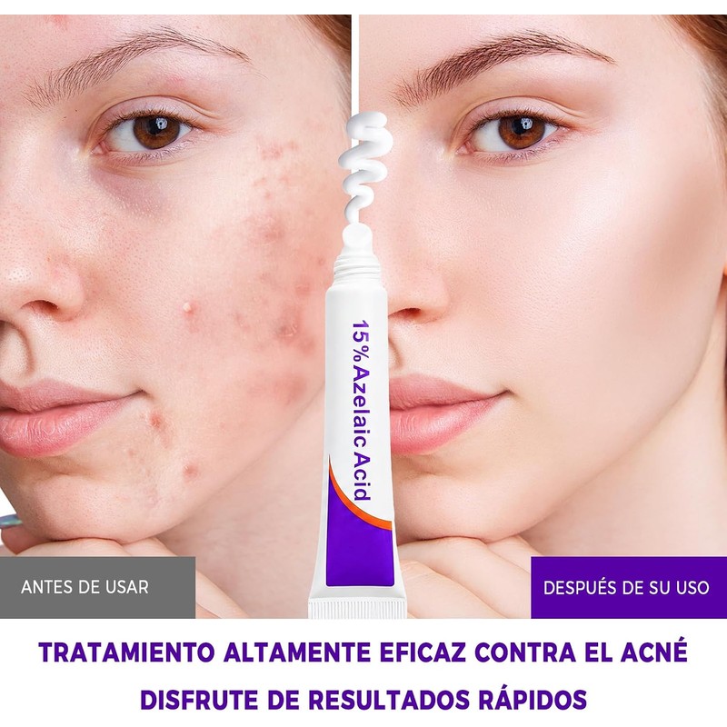 3PCS Crema Ácido Azelaico, Suero Ácido Azelaico