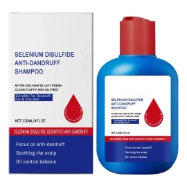 Champú Anticaspa Oil Control 300 Ml Scalp Nourish Para Hombr