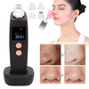 Visual Electric Blackhead Removal Machine Adjustable Vacuum Suction Face Pore