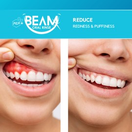 PEP+ BEAM Oral Rinse with Peptides & Xylitol – Travel Size Mouthwash for Gum Health, Fresh Breath & Oral Comfort – Alcohol Free Mouthwash for Adults & Kids – Non Toxic Mouth Rinse – 3.4 fl oz (100 mL)