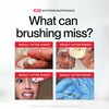 Hismile iD Stain Whitening Mouthwash, Gunk Removing Mouthwash for Fresh