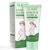 Stretch Marks Cream Prevent and Reduce Stretch Marks Pregnancy Safe