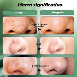 TEZXSAEW 200 Tiras para Puntos Negros de Carbon Activado Peel Off,para Ayudar a Destapar Los Poros,Quita Puntos Negros,Espinillas,Acne,Exceso de Grasa e Impurezas