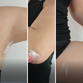 Crema Despigmentante Para Zonas Intimas Con Arbutina 100ml Tipo de piel Todo tipo de piel