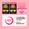 Spot Pink Vitamin Serum, 1.01 Fl Oz Suero De Vitamina