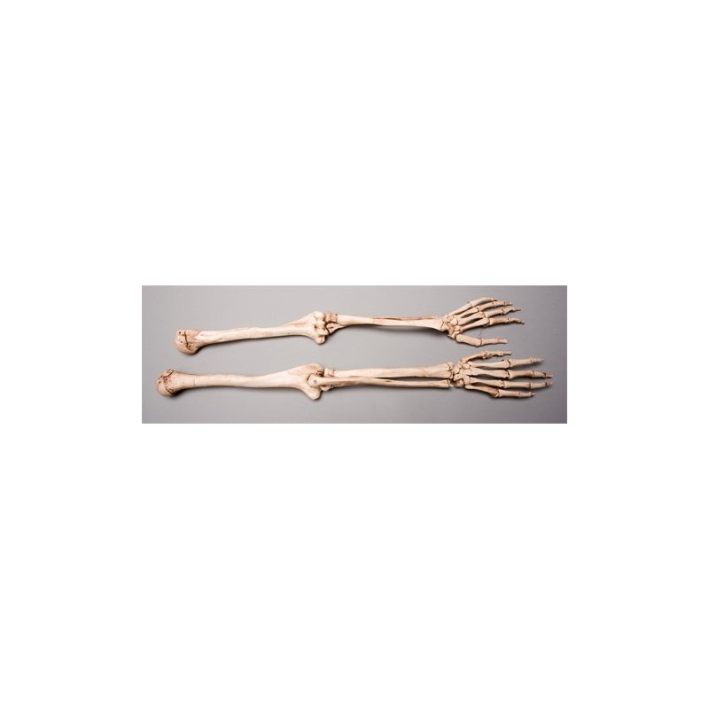 Skeletons And More Skeleton Arms- Life-Size- Pair- 2nd Class- Aged