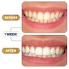 Lumineux Teeth Whitening Strips Kit - 9 Treatments - Peroxide