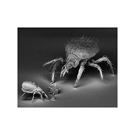 Dust Mites and Pollen under an Electron Microscope - Giclée - Print 16" tall x 20" wide
