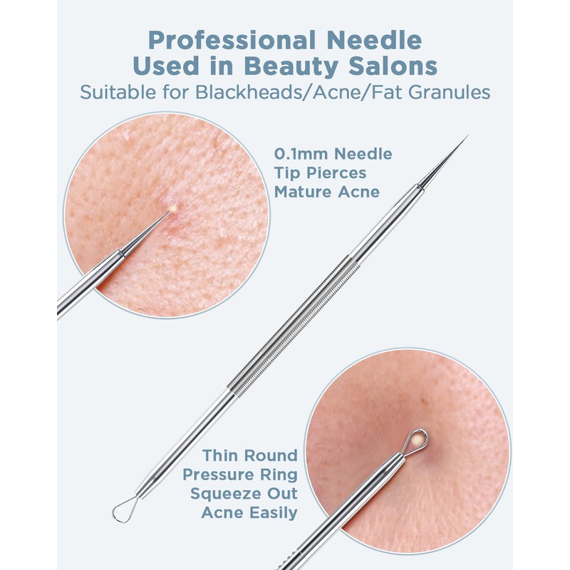 BESTOPE Blackhead Remover Blackhead Removal Pimple Comedone Extractor Tool -