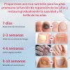 Líquido Para Hongos En Las Uñas Tratamiento Efectivo 50ml
