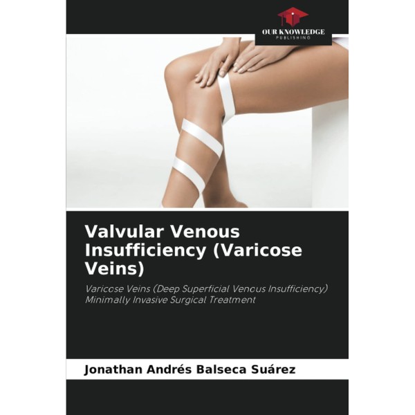 Valvular Venous Insufficiency (Varicose Veins): Varicose Veins (Deep Superficial Venous
