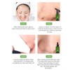 Face Nose Pores Shrinking Repairing Smoothing Blackhead Removal Liquid Essential