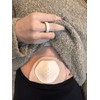 Stoma Safe | Stoma Protector | Stoma Shield | Ostomy
