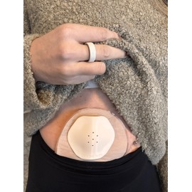 Stoma Safe | Stoma Protector | Stoma Shield | Ostomy Protector | Hernia Protector | Ostomy Bag