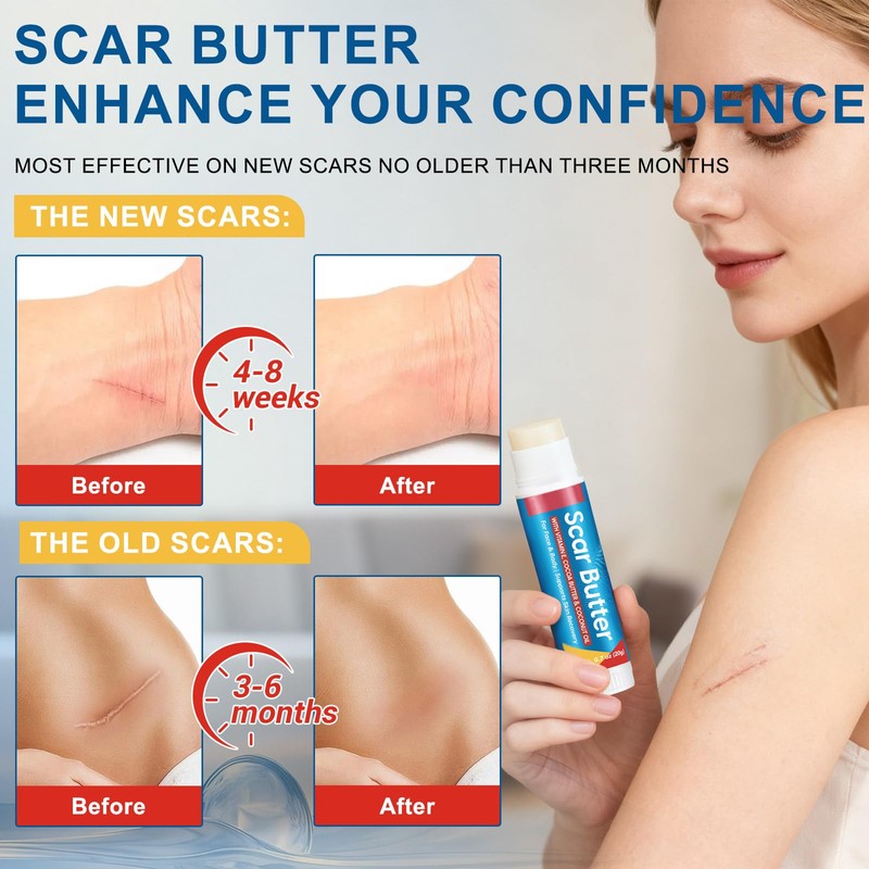 Scar Butter Stick with Vitamin E, Cocoa Butter & Coconut