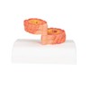 3B Scientific Human Anatomy - COPD Model + Free Anatomy