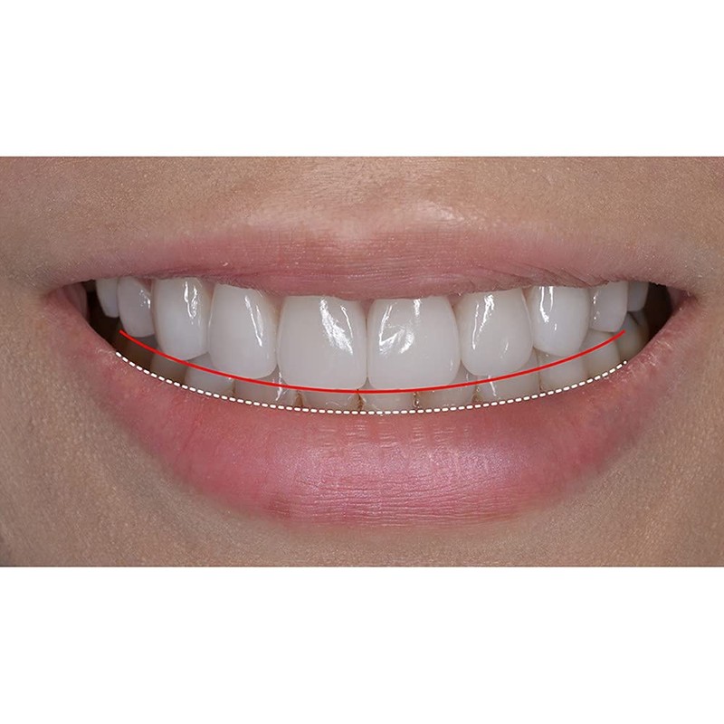 New Silicone Gel Smile Upper and Lower Cosmetic Teeth Tooth