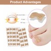 Ingrown Toenails Set, Toenail Correction, Toenail Patch, Toenail Correction Patch,