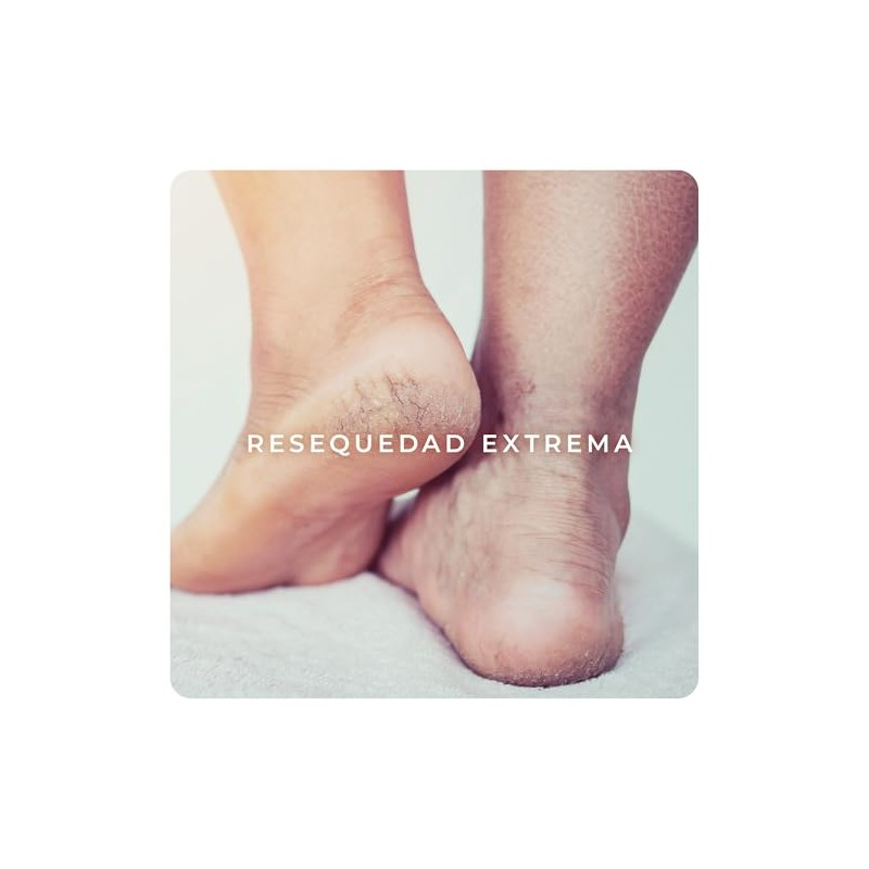 Derman DB Calm Emulsión Corporal │ Urea-D 10% + Ácido