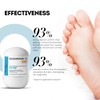 Regenerative Enzymatic Heel Peeling - Dissolves Thickened Skin & Calluses