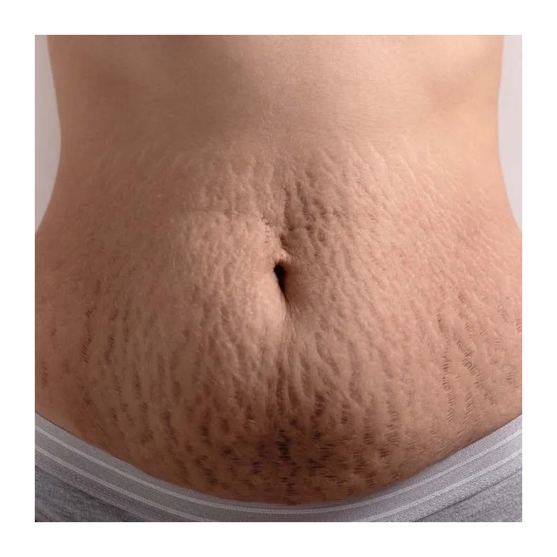 Crema Corporal Anticelulitis Y Estrías Reafirmante 300ml Neutra