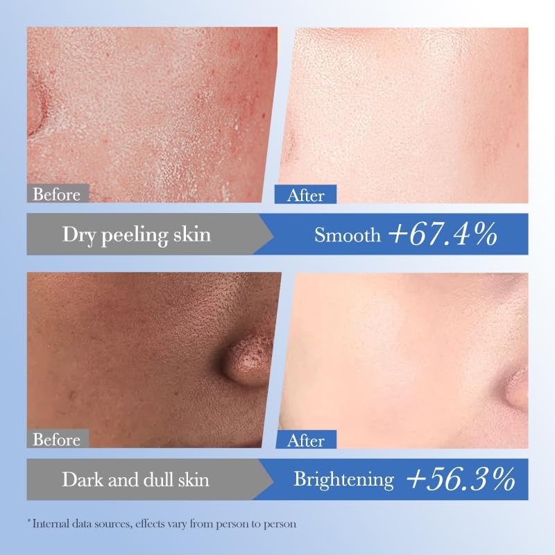 Ceramide Hyaluronic Acid Moisturizer reducing dryness Prevent dry smooth skin