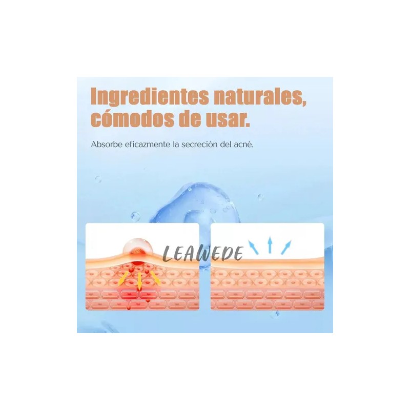 240pzs Mascarillas Estrella Para El Acne Espinillas Granos