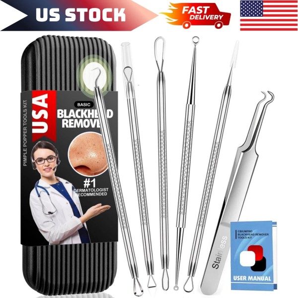 Unbranded Professional Facial Blackhead Remover Tweezers,Extra