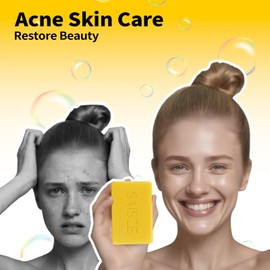 SAISZE Chlorine Removal Swimmers Soap, Vitamin C Body Wash Neutralizes and Washes Away Chlorine After Swimming for Swimmers and Athletes, 4 Ounce (Pack of 2